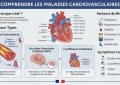 maladies cardiovasculaires